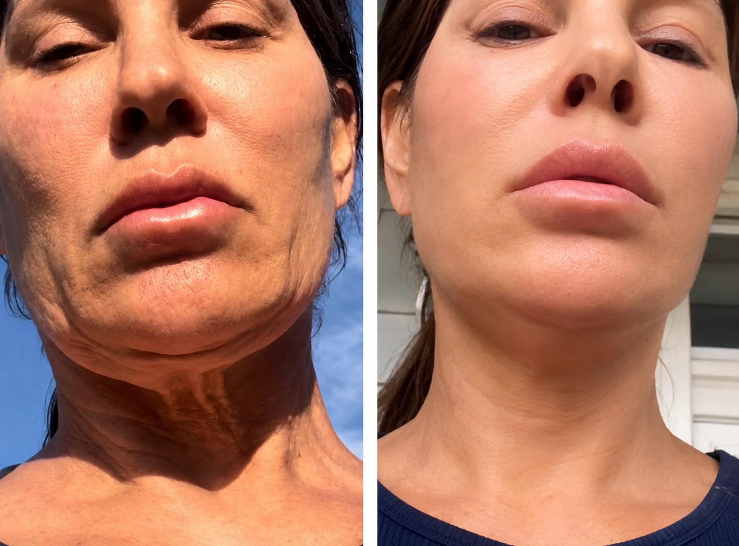 Dr. Ania Jastreboff and Oprah